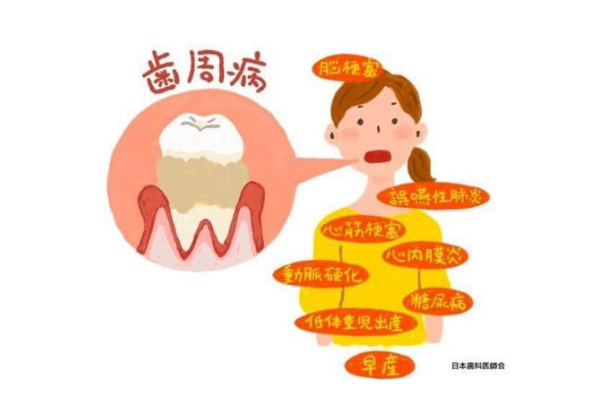 歯周病と全身疾患